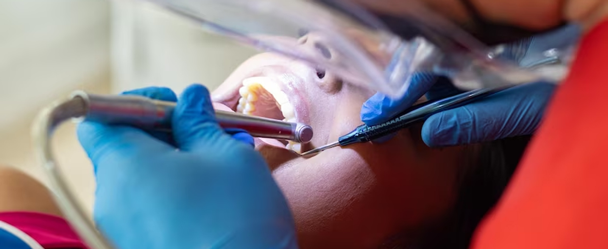 WHAT IS THE DIFFERENCE BETWEEN DENTAL FILLINGS & ROOT CANAL TREATMENT?